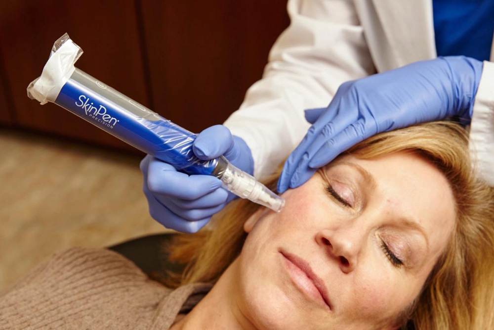 SkinPen Elite Microneedling
